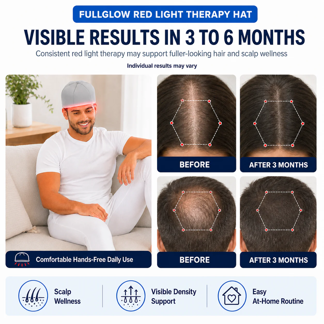 Red Light Therapy Cap — 660nm + 850nm
